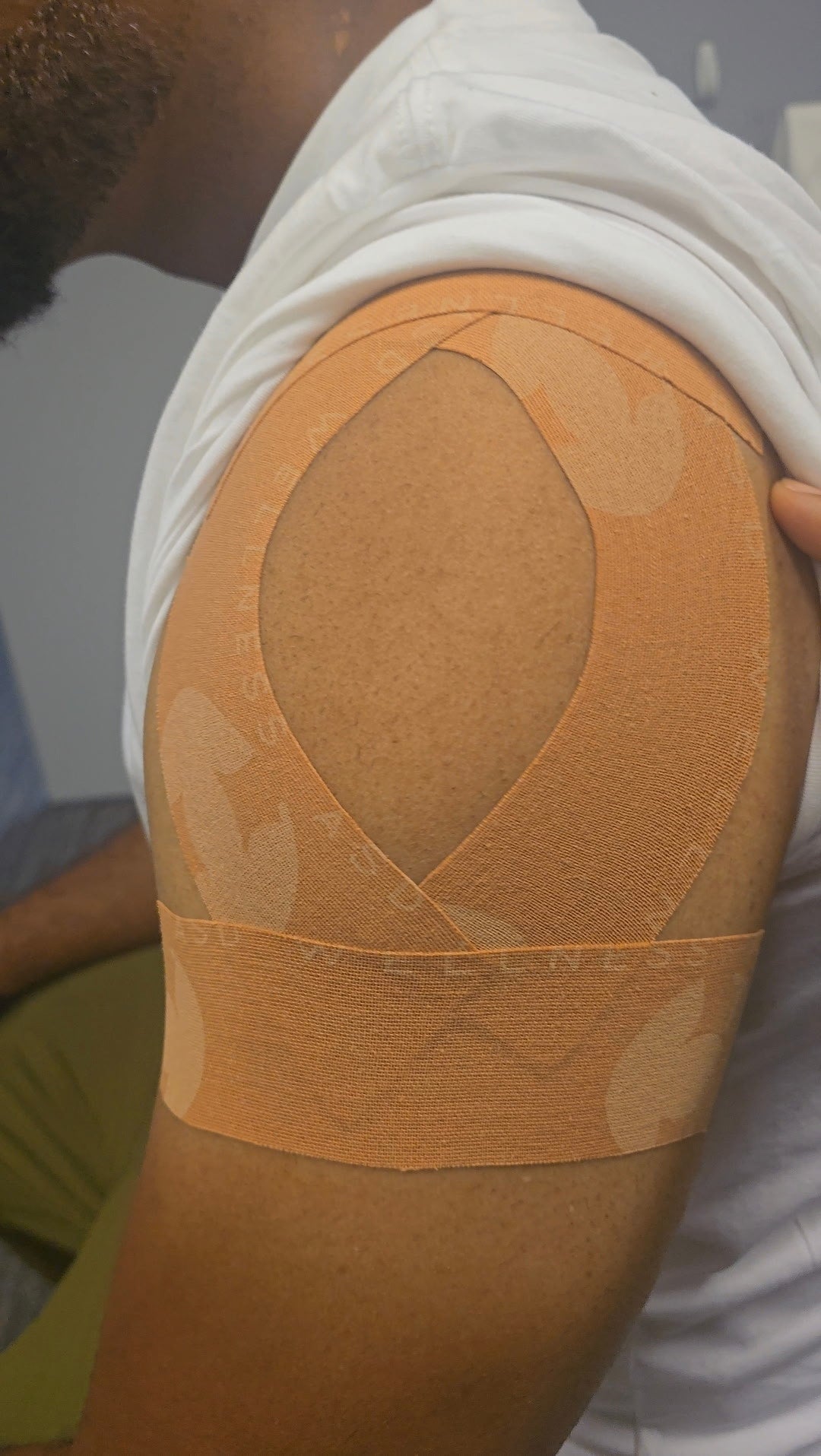 ASD Tape By Dr. Sanford