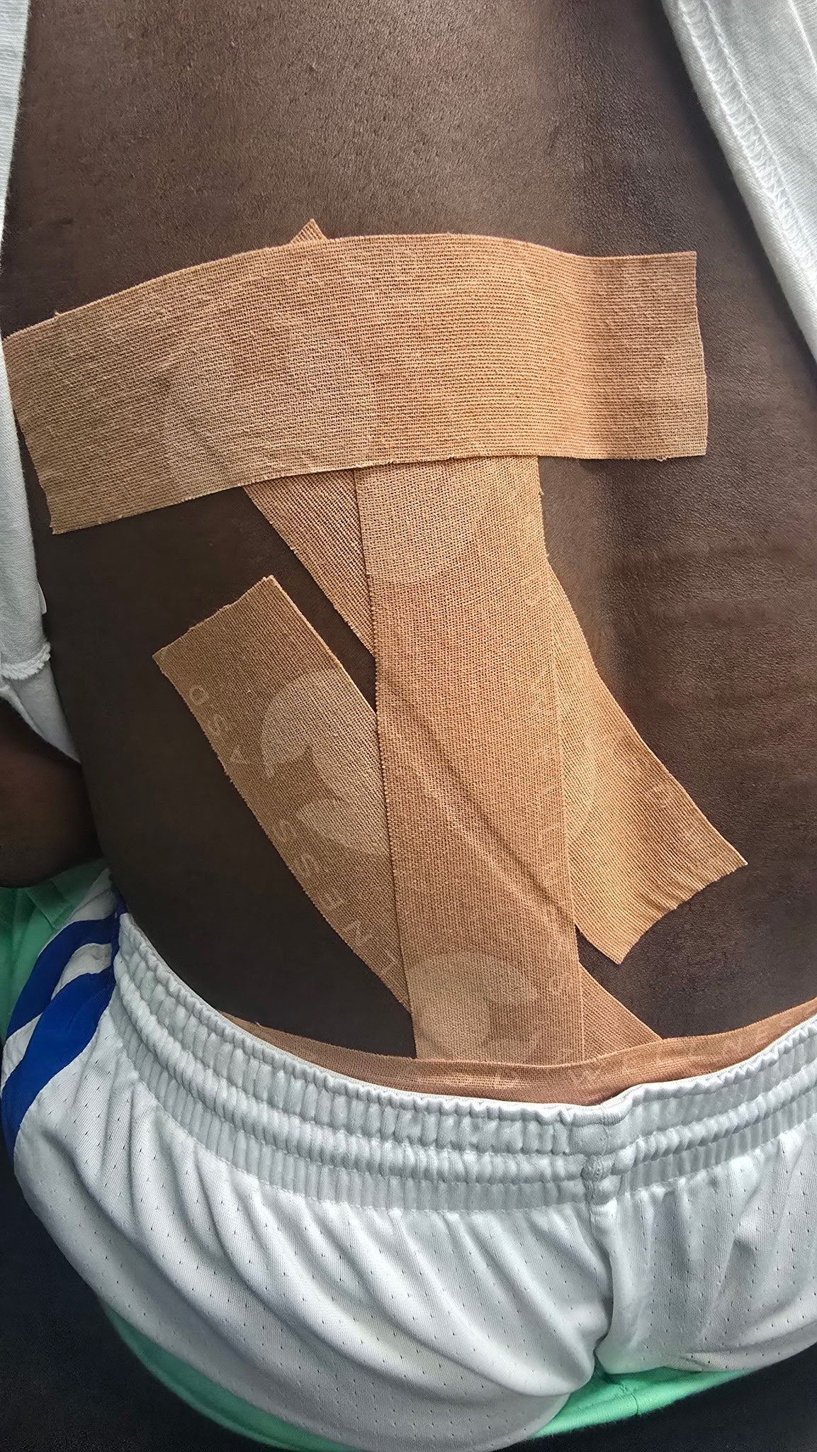 ASD Tape By Dr. Sanford